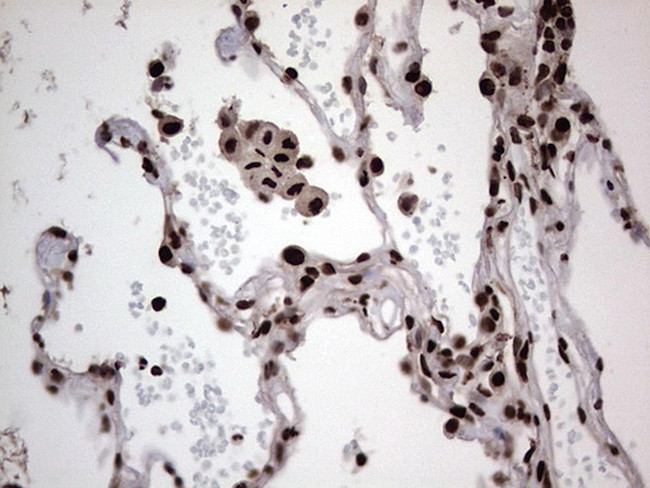 HNRNPL Antibody in Immunohistochemistry (Paraffin) (IHC (P))