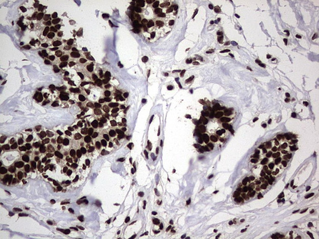 HNRNPL Antibody in Immunohistochemistry (Paraffin) (IHC (P))