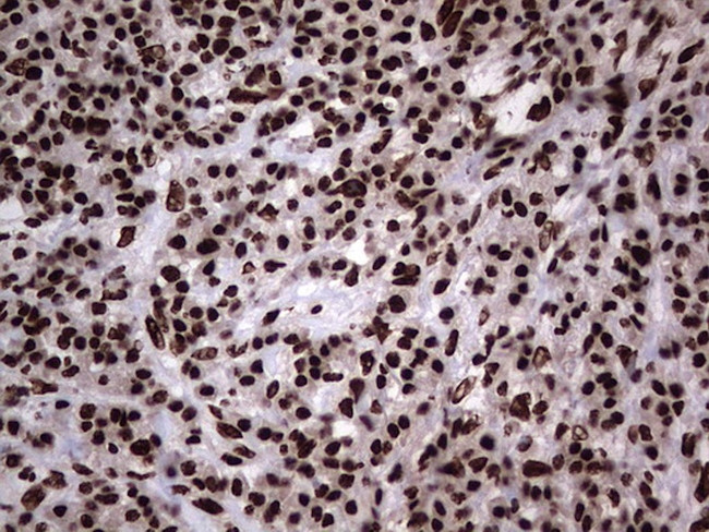 HNRNPL Antibody in Immunohistochemistry (Paraffin) (IHC (P))