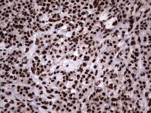 HNRNPL Antibody in Immunohistochemistry (Paraffin) (IHC (P))