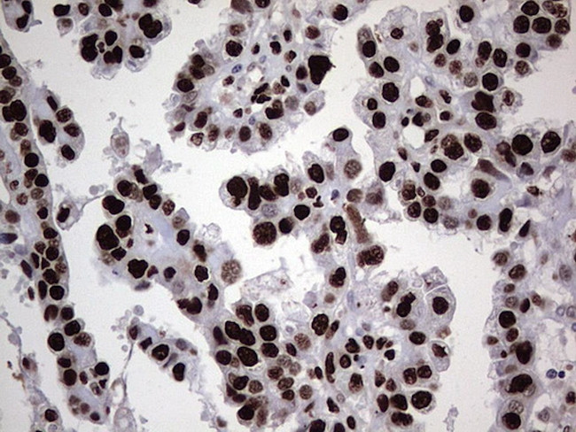 HNRNPL Antibody in Immunohistochemistry (Paraffin) (IHC (P))