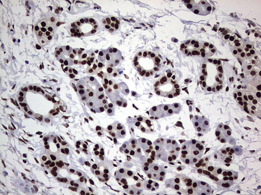 HNRNPL Antibody in Immunohistochemistry (Paraffin) (IHC (P))