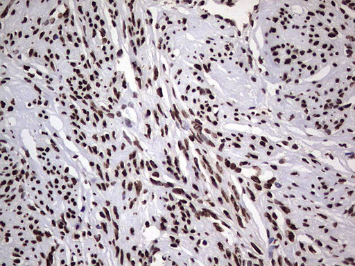 HNRNPL Antibody in Immunohistochemistry (Paraffin) (IHC (P))