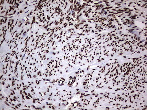 HNRNPL Antibody in Immunohistochemistry (Paraffin) (IHC (P))