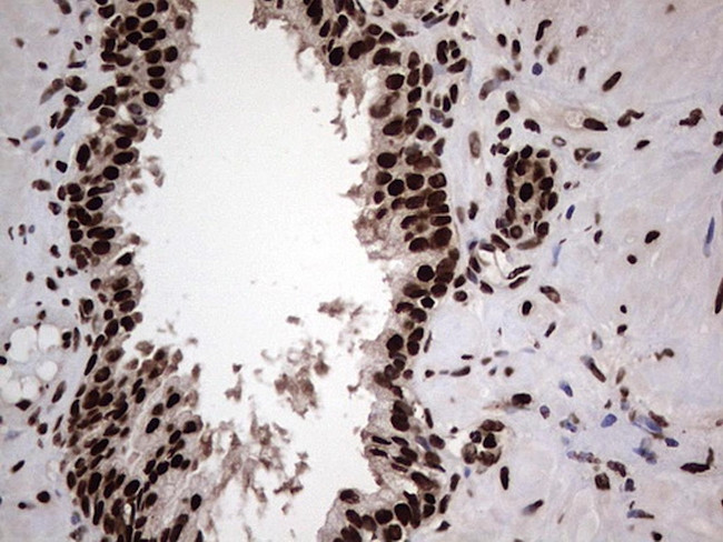 HNRNPL Antibody in Immunohistochemistry (Paraffin) (IHC (P))