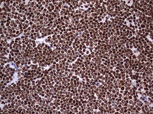 HNRNPL Antibody in Immunohistochemistry (Paraffin) (IHC (P))