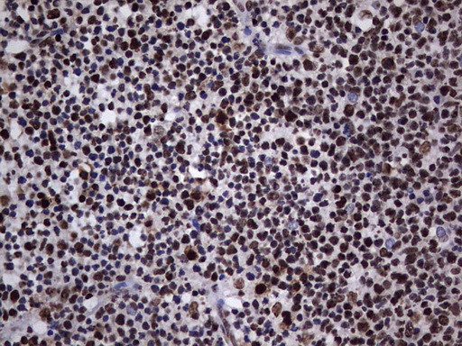 HNRNPL Antibody in Immunohistochemistry (Paraffin) (IHC (P))