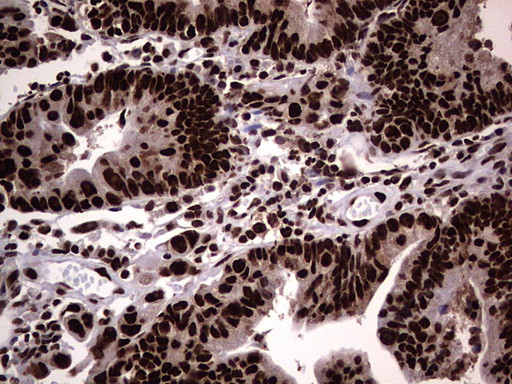 HNRNPL Antibody in Immunohistochemistry (Paraffin) (IHC (P))