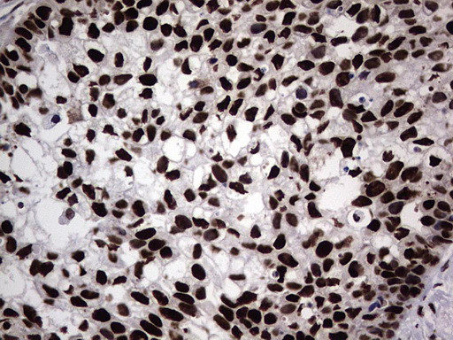 HNRNPL Antibody in Immunohistochemistry (Paraffin) (IHC (P))