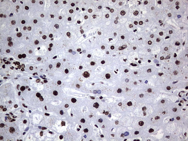 HNRNPL Antibody in Immunohistochemistry (Paraffin) (IHC (P))