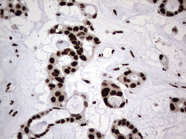 HNRNPL Antibody in Immunohistochemistry (Paraffin) (IHC (P))