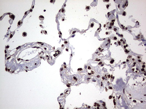 HNRNPL Antibody in Immunohistochemistry (Paraffin) (IHC (P))