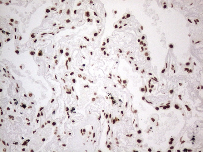 HNRNPL Antibody in Immunohistochemistry (Paraffin) (IHC (P))