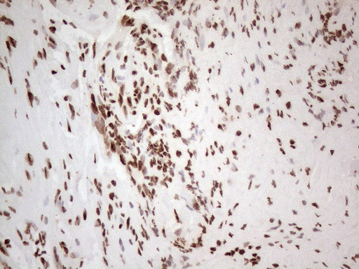 HNRNPL Antibody in Immunohistochemistry (Paraffin) (IHC (P))