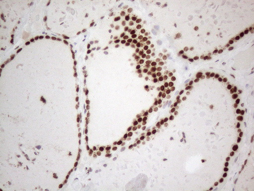 HNRNPL Antibody in Immunohistochemistry (Paraffin) (IHC (P))