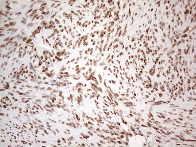 HNRNPL Antibody in Immunohistochemistry (Paraffin) (IHC (P))