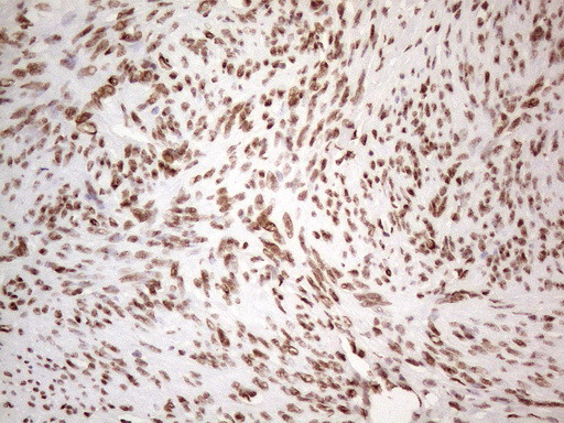 HNRNPL Antibody in Immunohistochemistry (Paraffin) (IHC (P))