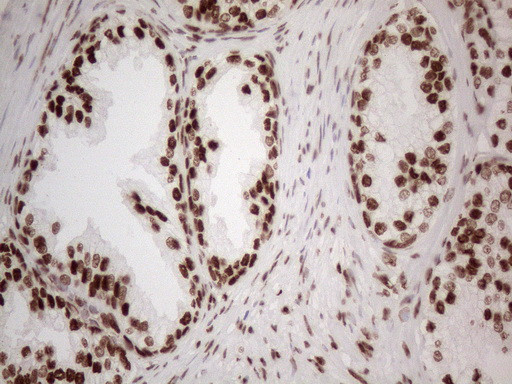 HNRNPL Antibody in Immunohistochemistry (Paraffin) (IHC (P))