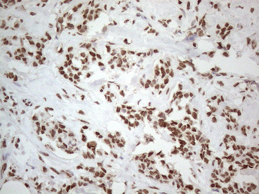 HNRNPL Antibody in Immunohistochemistry (Paraffin) (IHC (P))