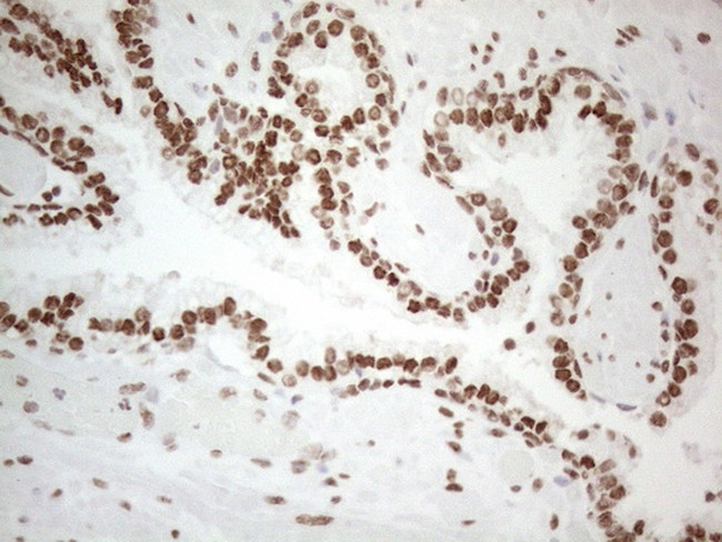 HNRNPL Antibody in Immunohistochemistry (Paraffin) (IHC (P))