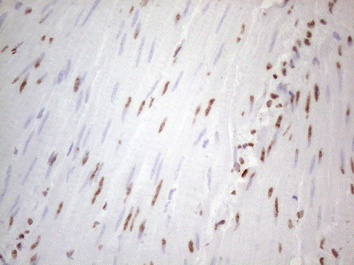 HNRNPL Antibody in Immunohistochemistry (Paraffin) (IHC (P))