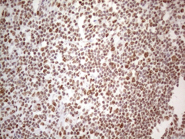 HNRNPL Antibody in Immunohistochemistry (Paraffin) (IHC (P))