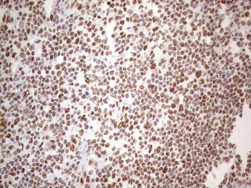 HNRNPL Antibody in Immunohistochemistry (Paraffin) (IHC (P))