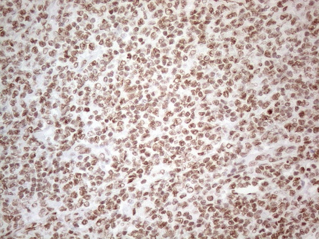 HNRNPL Antibody in Immunohistochemistry (Paraffin) (IHC (P))