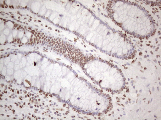 HNRNPL Antibody in Immunohistochemistry (Paraffin) (IHC (P))