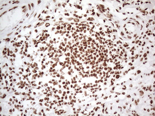 HNRNPL Antibody in Immunohistochemistry (Paraffin) (IHC (P))