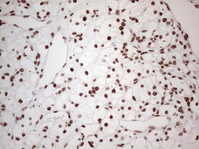 HNRNPL Antibody in Immunohistochemistry (Paraffin) (IHC (P))