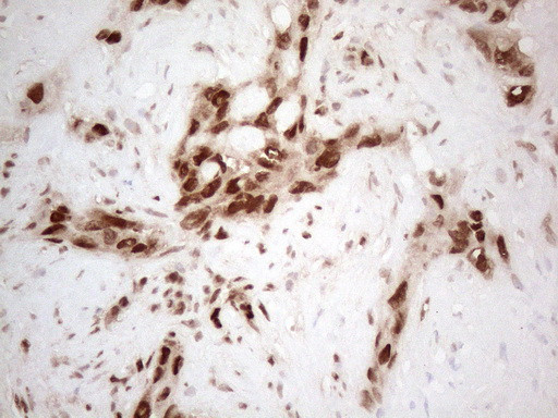 HNRNPL Antibody in Immunohistochemistry (Paraffin) (IHC (P))