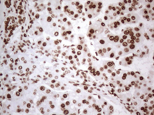 HNRNPL Antibody in Immunohistochemistry (Paraffin) (IHC (P))