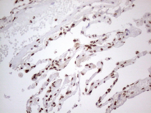 HNRNPL Antibody in Immunohistochemistry (Paraffin) (IHC (P))