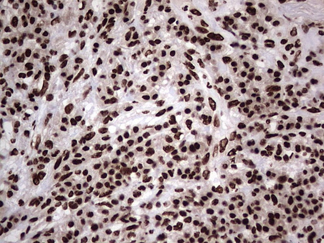 HNRNPL Antibody in Immunohistochemistry (Paraffin) (IHC (P))