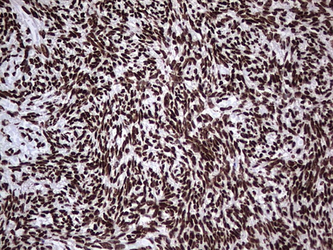 HNRNPL Antibody in Immunohistochemistry (Paraffin) (IHC (P))