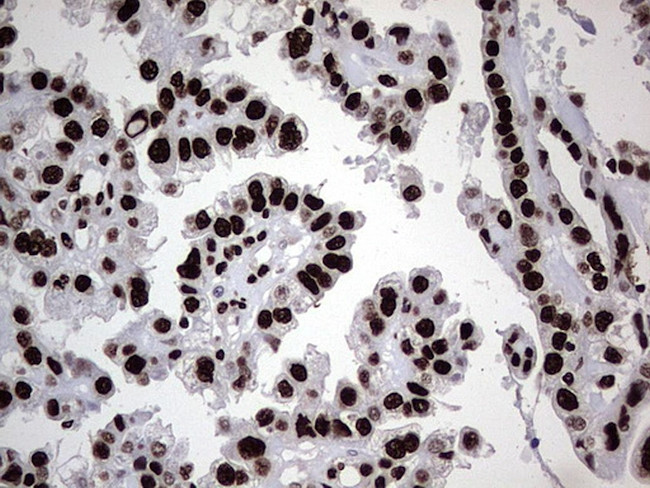 HNRNPL Antibody in Immunohistochemistry (Paraffin) (IHC (P))