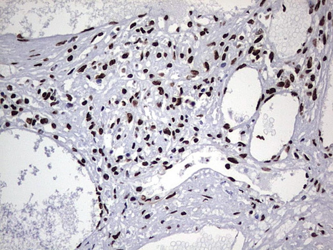 HNRNPL Antibody in Immunohistochemistry (Paraffin) (IHC (P))