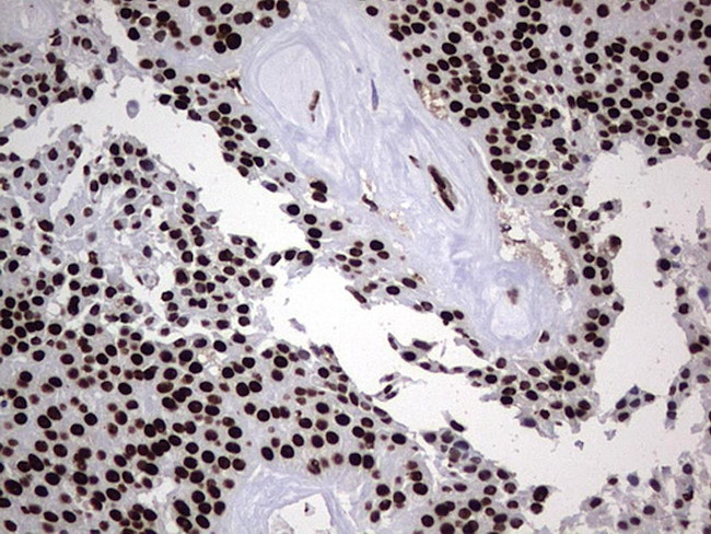 HNRNPL Antibody in Immunohistochemistry (Paraffin) (IHC (P))