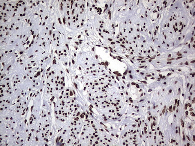 HNRNPL Antibody in Immunohistochemistry (Paraffin) (IHC (P))