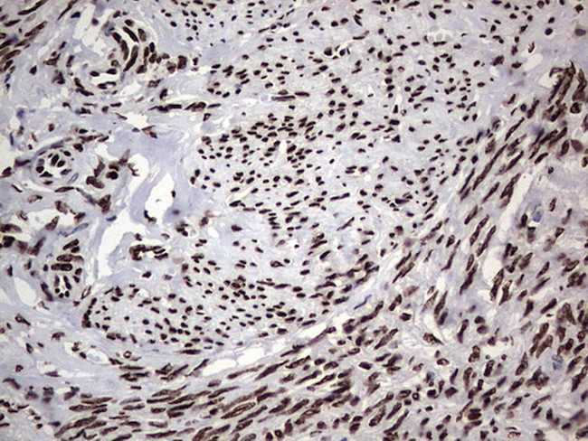 HNRNPL Antibody in Immunohistochemistry (Paraffin) (IHC (P))