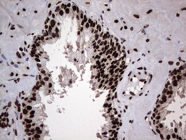 HNRNPL Antibody in Immunohistochemistry (Paraffin) (IHC (P))