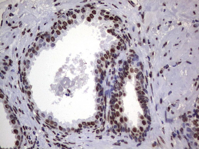 HNRNPL Antibody in Immunohistochemistry (Paraffin) (IHC (P))