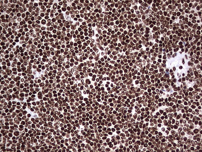 HNRNPL Antibody in Immunohistochemistry (Paraffin) (IHC (P))