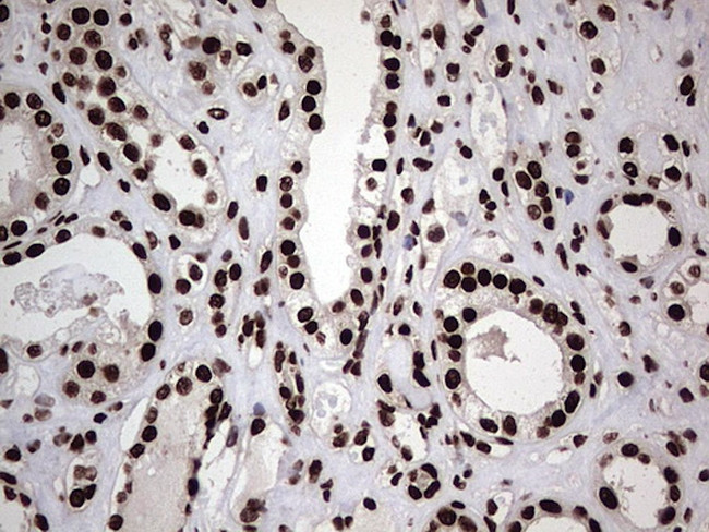 HNRNPL Antibody in Immunohistochemistry (Paraffin) (IHC (P))