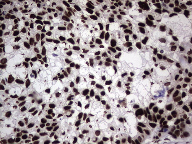 HNRNPL Antibody in Immunohistochemistry (Paraffin) (IHC (P))