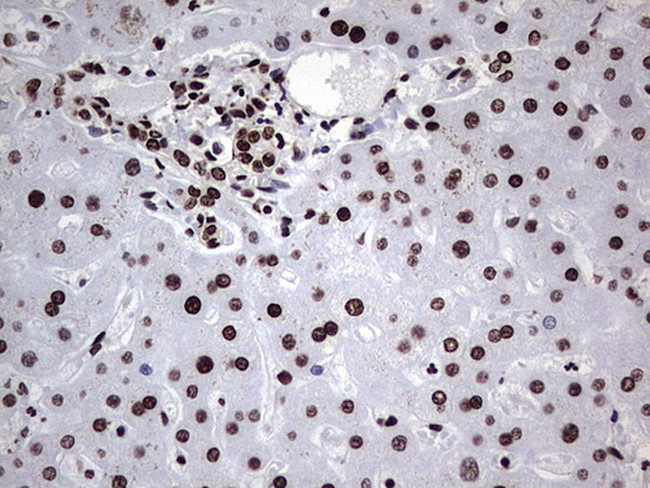 HNRNPL Antibody in Immunohistochemistry (Paraffin) (IHC (P))