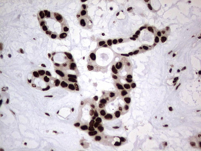 HNRNPL Antibody in Immunohistochemistry (Paraffin) (IHC (P))