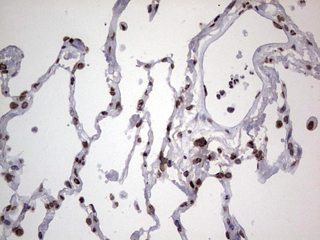 HNRNPL Antibody in Immunohistochemistry (Paraffin) (IHC (P))