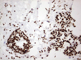 HNRNPM Antibody in Immunohistochemistry (Paraffin) (IHC (P))